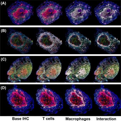 Corrigendum: Spatial Organization and Recruitment of Non-Specific T Cells May Limit T Cell-Macrophage Interactions Within Mycobacterium tuberculosis Granulomas